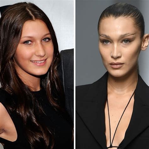 bella hadid buccal fat removal|6 ways to get a slimmer face – and not just buccal fat removal